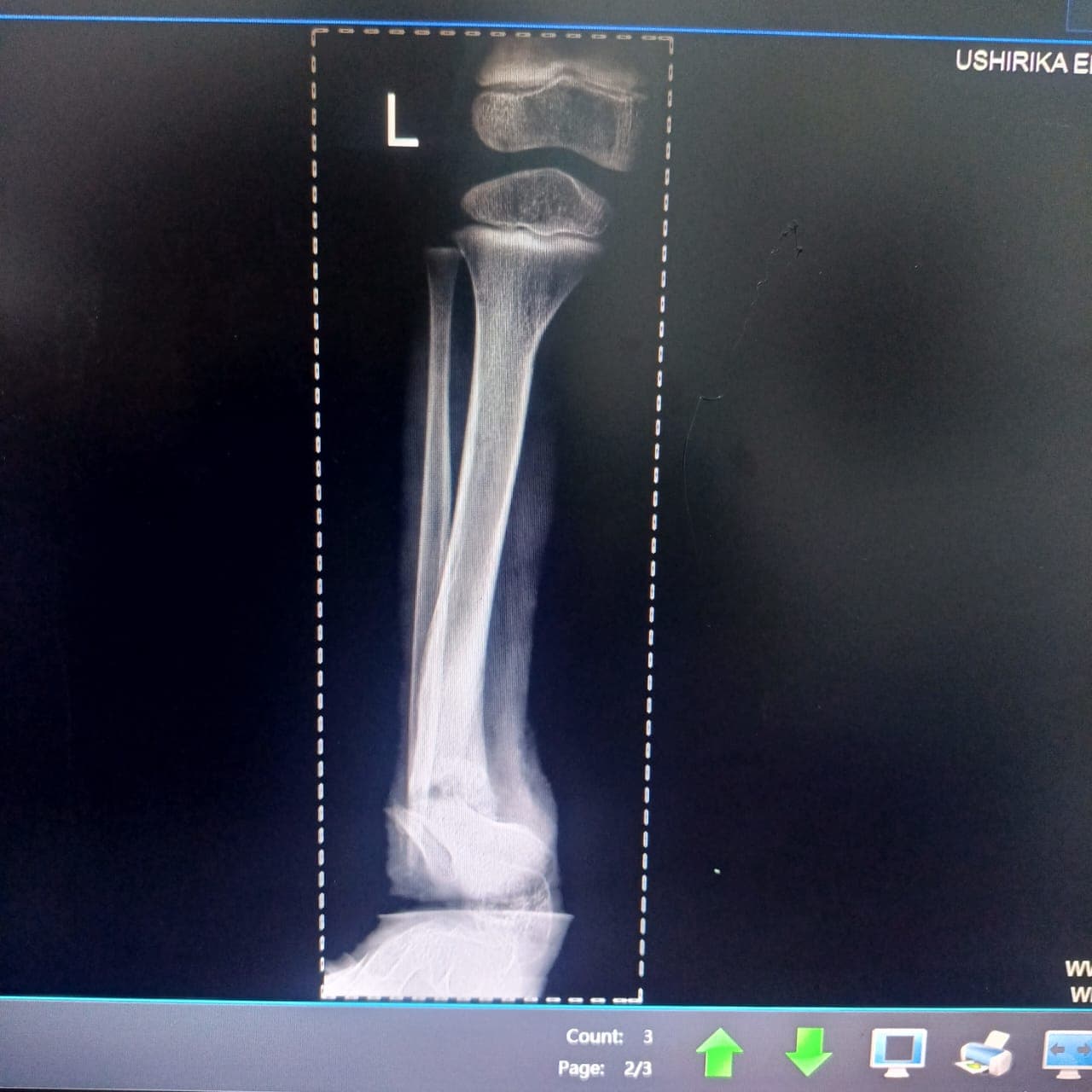 Impact story photo 3