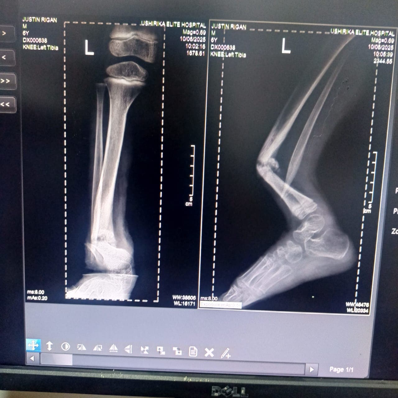 Impact story photo 5